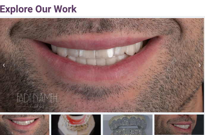 Ein Bildschirmfoto von Fadi Namehs Dental Lab Galerie früherer Arbeiten